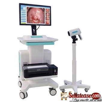 CAPOLSCOPY MACHINE IN NIGERIA BY SCANTRIK MEDICAL SUPPLIES