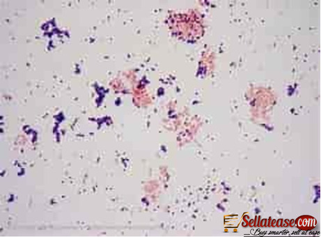 GRAM  STAIN POSITIVE DISC