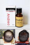 Andrea hair and beard growth oil in Nigeria