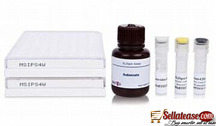ELLISPOT TUBERCULOSIS KIT