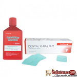 100pc X-Ray Film Reader Scanner