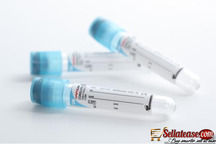 Medical Rapid Action Medical Sodium Citrate Collection Tubes