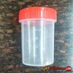 URINE CONTAINER 40ML
